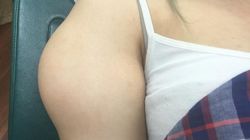 VIDEO I-a aparut o umflatura ciudata pe mana si a mers de urgenta la medic! Pana si specialistul a ramas mut cand a avazut ce se afla sub piele