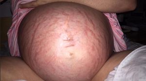 Saraca gravida! Cat a putut sa indure timp de noua luni! Adevarul socant despre sarcina femeii novalue