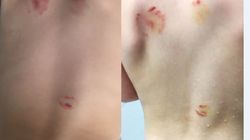 Copil de 1 an si 8 luni, muscat violent la gradinita. Educatoarele au musamalizat incidentul, iar cel mic a ramas cu traume