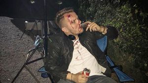 Codin Maticiuc, plin de sange! Imagine socanta cu craiul de Dorobanti