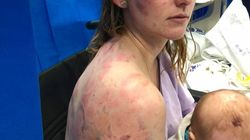 O mamă şi-a protejat fetiţa cu propriul trup în timpul unei furtuni cu grindină. Imaginile sunt de-a dreptul şocante: „Când mi-au dat hainele jos...”