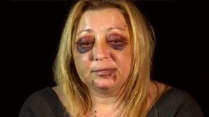 Dramă de nedescris pentru o femeie de 40 de ani! A fost violată şi desfigurată de fostul iubit. Declaraţiile sunt cutremurătoare