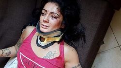 Imagini horror! Dansatoarea Alexandra a fost bătută crunt de mai mulți bărbați, în Italia