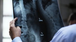 Caz uluitor în Botoșani! Un bărbat a ajuns la spital cu un pahar în fund! Ce le-a zis medicilor