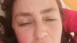 Rona Hartner rupe tăcerea: „Eram în pericol să mor!” Ce au descoperit medicii fin Franța