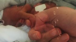 A murit bebelușul de doar 720 de grame, născut ieri, la Botoșani. Medicii au reușit să-l țină în viață doar o zi