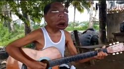 A crezut că este răcit și a mers la spital! La scurt timp, fața a început să i se umfle, oamenii cred că e un monstru