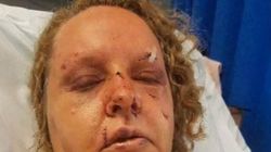 O femeie a fost bătută cu sălbăticie de soțul ei! A mutilat-o și a băgat-o în spital, iar după ce a stat de vorbă cu Poliția, femeia a aflat cine era el, de fapt 
