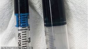 Femeia a fost tratată cu albastru de metilen