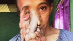 Natalia avea tumori pe toată fața! Cum arată acum, după operație: „Nu trebuie să îmi mai ascund chipul!”