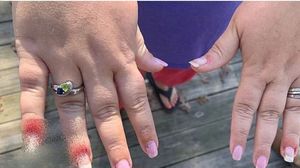 O femeie a mers să-și pună unghii false, dar a fost la un pas să rămână fără degete! I s-au umflat și sunt pline cu puroi