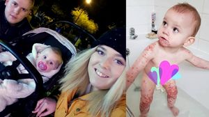 Bebeluș, la un pas de moarte după ce o rudă l-a pupat pe gură