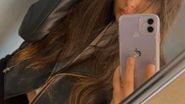 O boală rară a ucis o tânără de doar 20 de ani din Vaslui. Aceeași boală o chinuie și pe Selena Gomez.