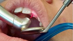 Află acum modul în care îți poți trata dinții fără durere!