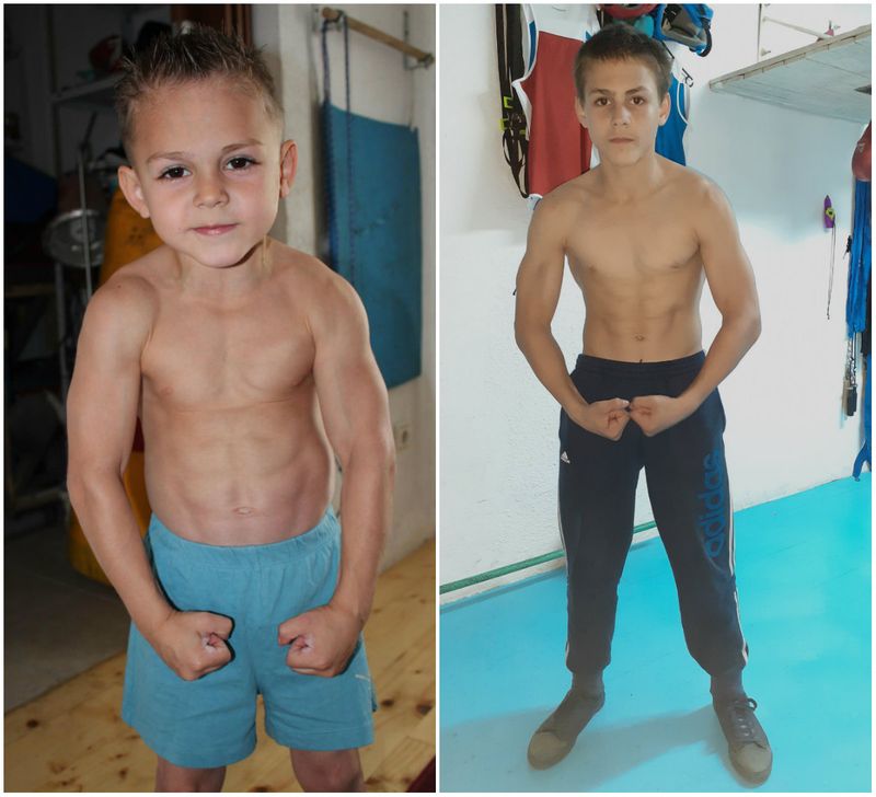 Cum arată astăzi &rdquo;Micul Hercule&rdquo;, cel mai puternic copil din lume