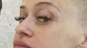 Cum arată Anda Adam după operația de rinoplastie!
