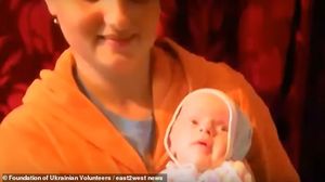 Video șocant! O fetiță de doar opt ani a murit de bătrânețe, fiind cea mai tânără persoană din lume moartă. Boala rară care a măcinat-o până la moarte