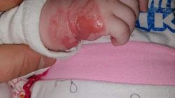 O mamă din Vulcan, acuzații grave la adresa cadrelor medicale! Ce a descoperit când s-a uitat la branula de la mâna fetiței sale