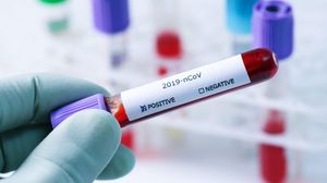 A fost descoperită o nouă metodă de detectare a coronavirusului. Despre ce este vorba