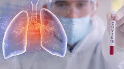 Anunțul care dă totul peste cap. Riscuri uriașe pentru pacienții vindecați de coronavirus:  „Afectează toate organele”