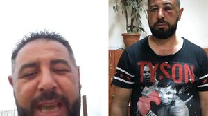 Spartacus și ceilalți romi care au șocat țara au primit cea mai dură lovitură