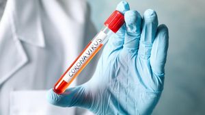 UPDATE Coronavirus a făcut încă 14 victime în România. Bilanțul s-a ridicat la 541