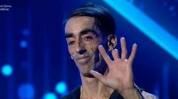 Acrobatul mascat, desfigurat de pasiunea sa! Cercul de 25 de kilograme l-a lăsat fără degete. "Un număr impecabil"