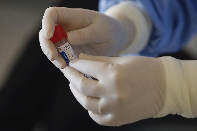 Coronavirus România: 401 noi cazuri de îmbolnăvire, numărul total ajungând la 11.036