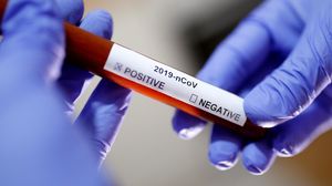 Încă șase români au murit din cauza coronavirusului. Bilanțul a ajuns la 723