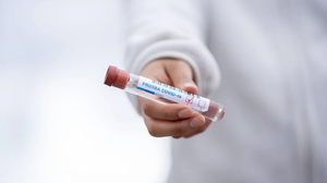 17 decese provocate de coronavirus au fost confirmate azi! Bilanțul în România 