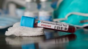 Coronavirus face încă 14 victime în România. Bilanțul a ajuns la 1.070