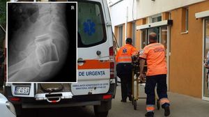 Un botoșănean a venit la spital cu un borcan băgat în posterior