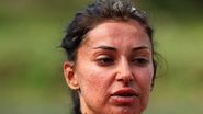 elena-ionescu-acnee-ten-survivor