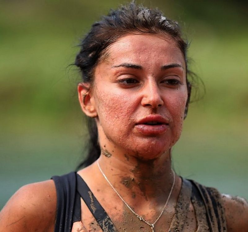 elena-ionescu-acnee-ten-survivor