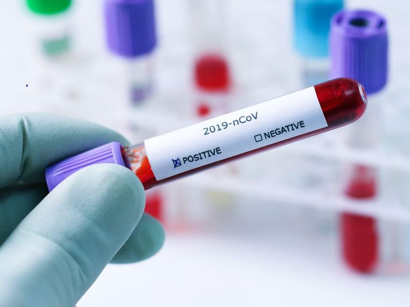 Alertă maximă! Zeci de credincioși au fost infectați cu COVID-19 după ce au luat parte la o slujbă religioasă