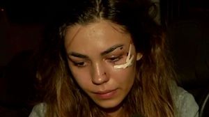 Cântăreața Mira, implicată într-un alt accident rutier!