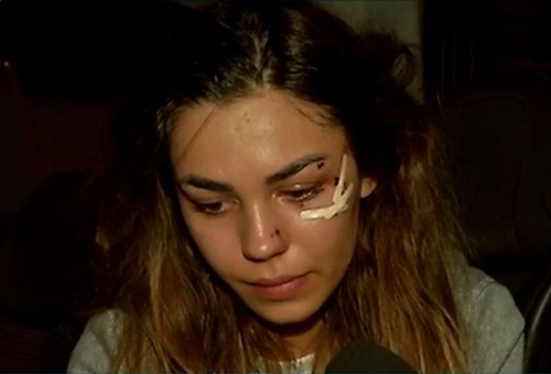 C&acirc;ntăreața Mira, implicată &icirc;ntr-un alt accident rutier!