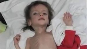 Transformarea Florentinei, copila hrănită până la 4 ani doar cu pufuleți! A fost salvată de la moarte în urmă cu 6 ani, iar acum este o adolescentă superbă