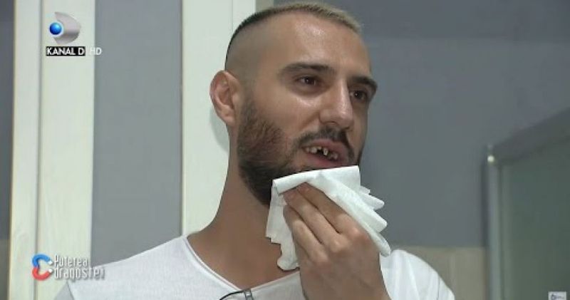 marius Marius de la Puterea dragostei, declarație șocantă după ce a rămas fără trei dinți: „Norocul meu că...”