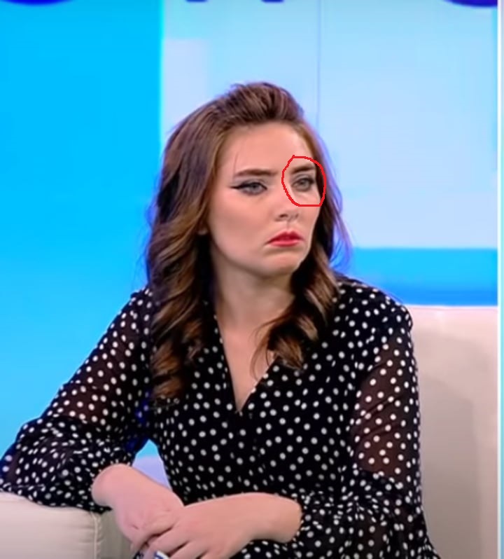 Emily Burghelea a spus adevărul! Iată dovada că Vulpița a fost bătută de Viorel