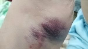 Bunicul lui Laurette a fost externat din spital plin de vânătăi