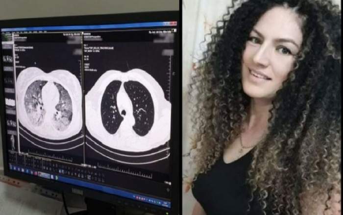 Diagnosticată și tratată pentru ceva, dar decesul a fost datorită COVID-19: cazul halucinant al tinerei de 39 de ani decedată subit