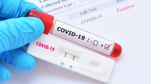 Bilanț coronavirus România 1 iulie! 326 de noi cazuri și 16 morți