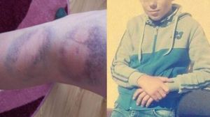 Tulburător! Profesoară agresată de un elev de 12 ani. Femeia a fost bătută cu o țeavă. Părinții, obligați să plătească daune morale