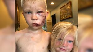 Un băiețel de 6 ani și-a salvat sora mai mică de mușcătura unui câine! Povestea băiețului a ajuns virală în toată lumea!