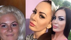 Bianca Pop, pe masa de operație! Ce se întâmplă cu celebra ispită?