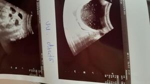 Un bărbat, abandonat de soție din cauza problemelor de sănătate, se luptă să-și salveze viața. Vladimir are nevoie de urgent de 12.000 de euro pentru a putea trăi. „Soția mea se săturase”