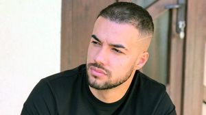 Culiță Sterp, primele imagini după ce și-a făcut implantul de păr