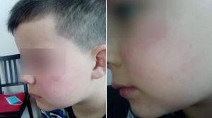 Ireal! Un băiețel de 7 ani a fost bătut cu bestialitate de tatăl unei colege! Învățătoare a luat parte  la scandal