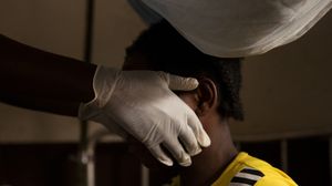 Primul locuitor din Dallas care a fost diagnosticat cu boala Monkeypox